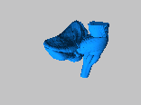 Brain Stem and Posterior Lobe of the Cerebullum.2